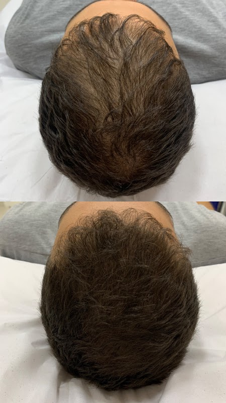 Estética Avançada Carine Nogueira - Clínica de Estética em Campo Grande, Cariacica/ES - Foto 2