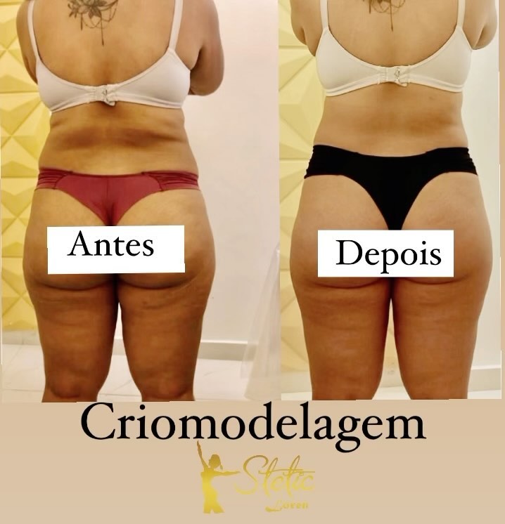 Stetic Loren - Clínica de Estética em Campo Grande, Cariacica/ES - Foto 3