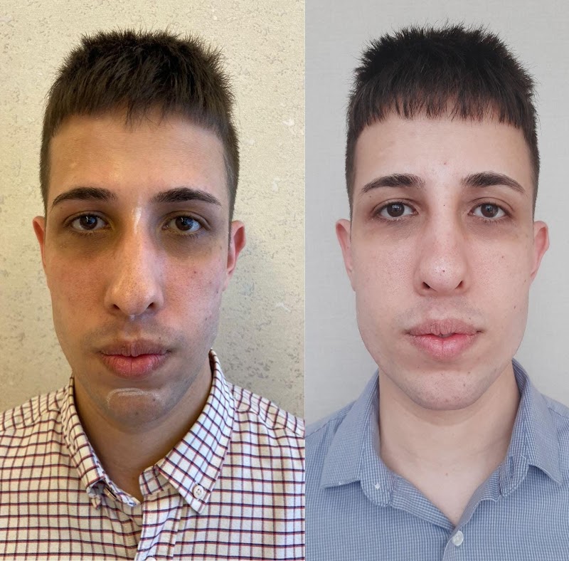 Dra Letícia Gáve harmonização facial e corporal - Clínica de Estética em Rio Branco, Cariacica/ES - Foto 3