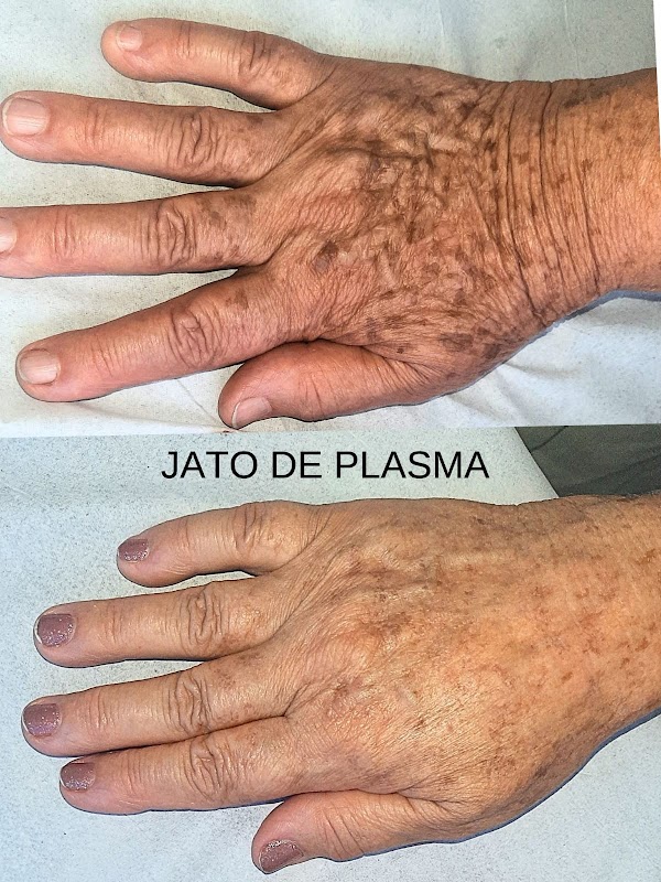 Dra Letícia Gáve harmonização facial e corporal - Clínica de Estética em Rio Branco, Cariacica/ES - Foto 4