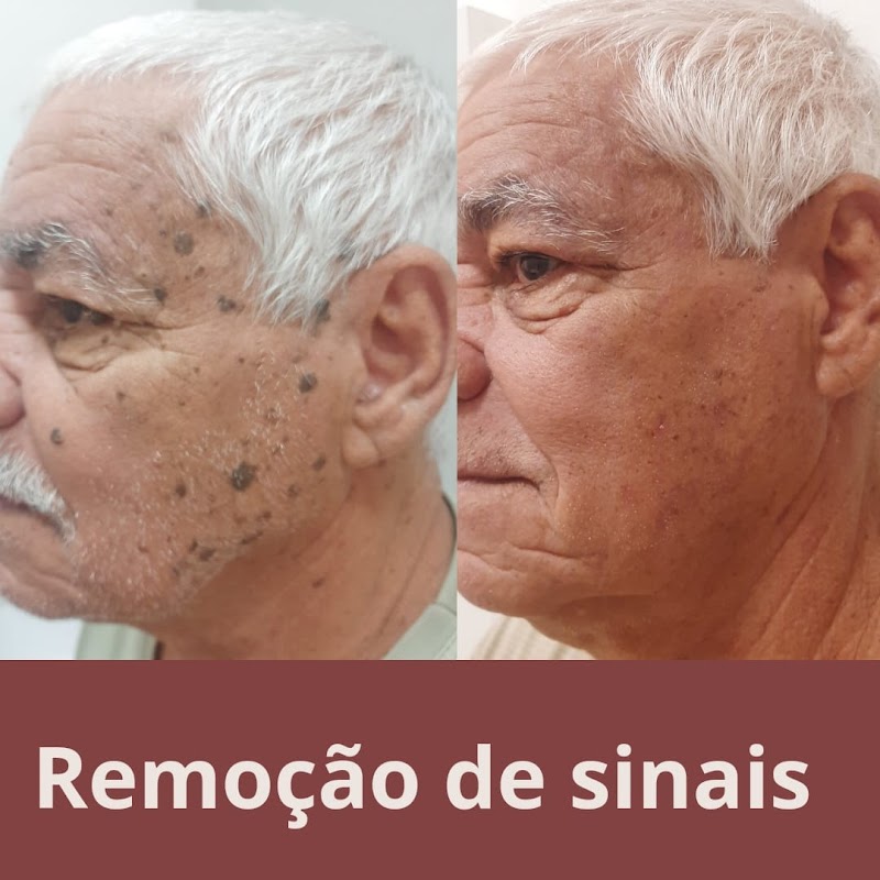 Dra Letícia Gáve harmonização facial e corporal - Clínica de Estética em Rio Branco, Cariacica/ES - Foto 5
