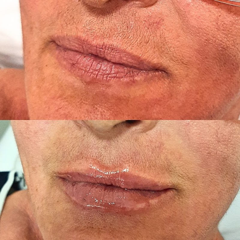 Foto 6 de Dra Letícia Gáve Harmonização Facial e Corporal