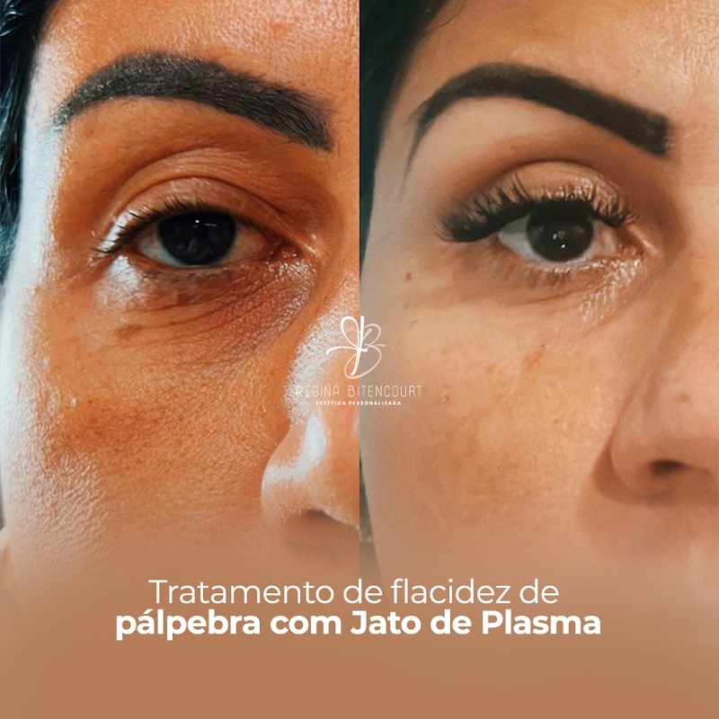 Estética Regina Bitencourt - Clínica de Estética em Rio Branco, Cariacica/ES - Foto 4