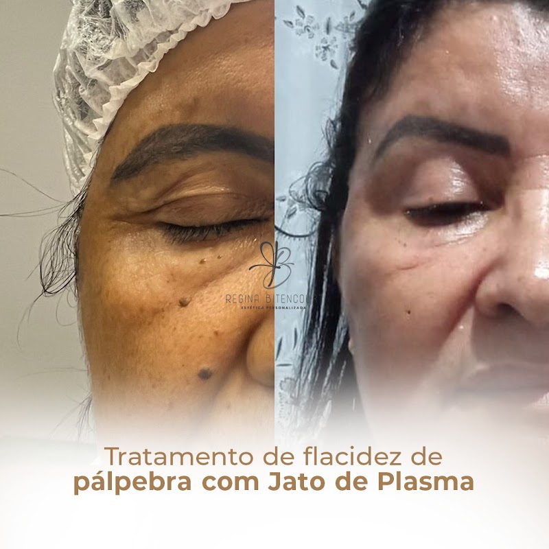 Estética Regina Bitencourt - Clínica de Estética em Rio Branco, Cariacica/ES - Foto 5