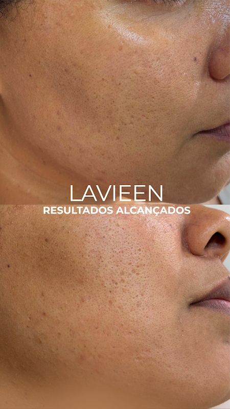 Foto 6 de Estética Regina Bitencourt