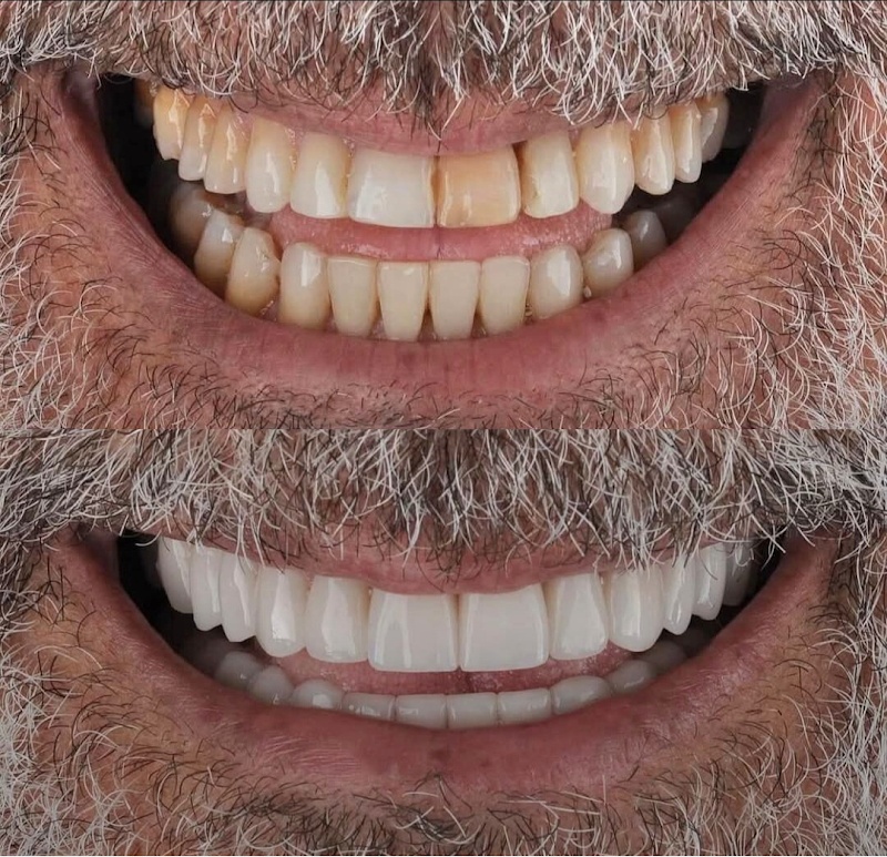 A Prime Odontologia - Clínica Odontológica em Campo Grande, Cariacica/ES - Foto 2