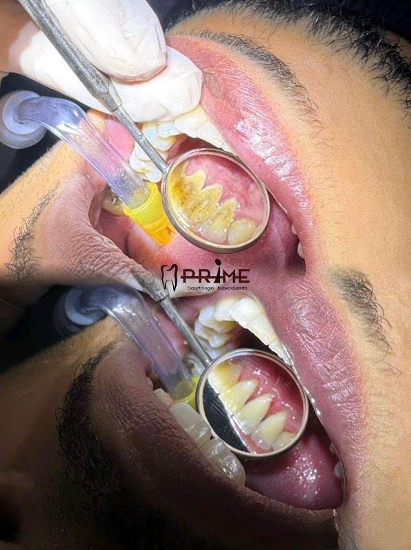 Á Prime Odontologia LTDA - Clínica Odontológica em Campo Grande, Cariacica/ES - Foto 3